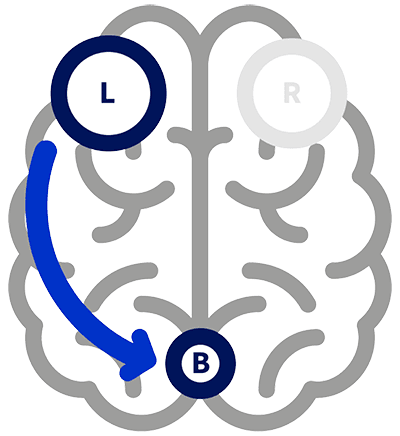 tDCS illustration